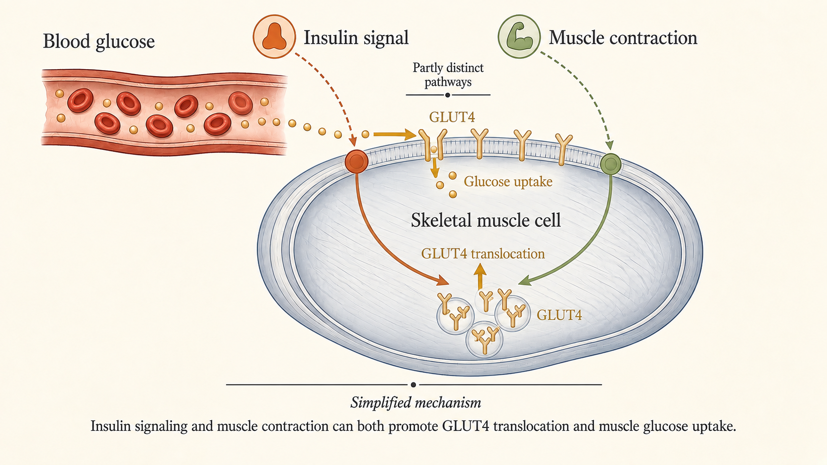 Diagram showing insulin and muscle-contraction signals moving GLUT4 transporters to a muscle-cell membrane.
